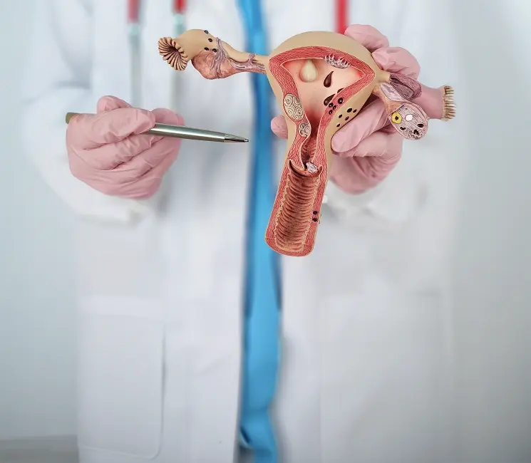 Gynaecologist holding an anatomical model of the uterus and ovaries during a patient consultation